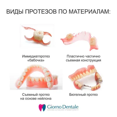 Зубные протезы: виды в Минске, стоимость протезирования