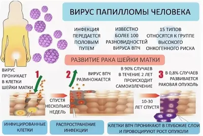 ВПЧ(Вирус папилломы человека) - Медицинский центр Медина +