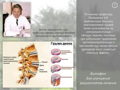 Фиксирующие манжеты к Витафону купить в интернет магазине Витаберри