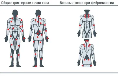 О болевых воздействиях Кюшо | Рукопашный бой