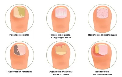 Ухудшение внешнего вида ногтей связано с рядом заболеваний - газета «Кафа»  новости Феодосии и Крыма