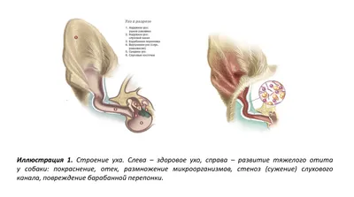 Краевая себорея ушных раковин