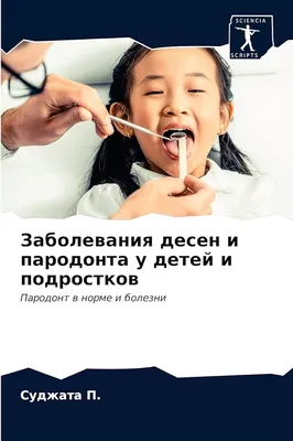 : Заболевания десен и пародонта у детей и подростков: Пародонт в  норме и болезни (Russian Edition): 9786203643374: П., Суджата: Books