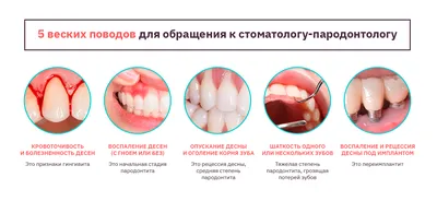 Профилактические действия болезни десен • Диагностический центр Вальдорф