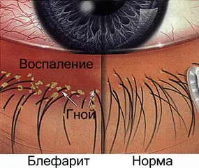Болезни глаз — блог медицинского центра ОН Клиник