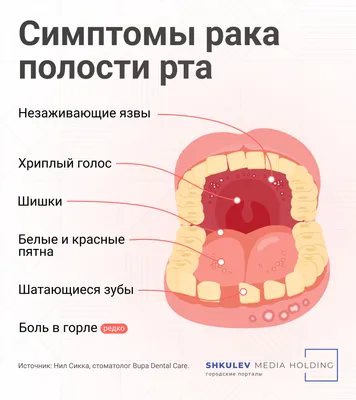 Болит ли горло при коронавирус?