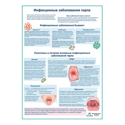 Заболевания горла 52 картинки