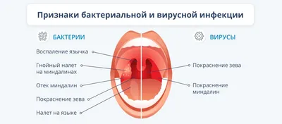 Першение в горле: как и чем лечить можно в домашних условиях?