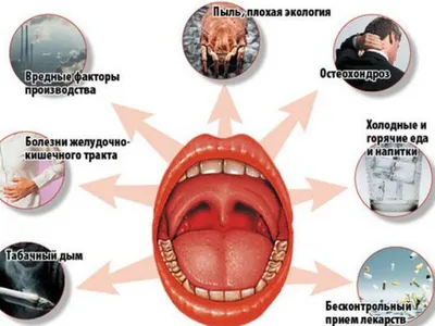 Заболевания горла Психосоматика (видео)