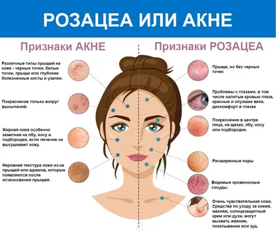 Заболевания кожи лица: Понимание, лечение и профилактика