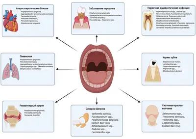 Инфекционные заболевания слизистой оболочки полости рта