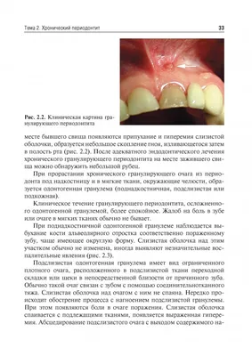 Книга Болезни слизистой оболочки полости рта и губ. Клиника, диагностика и  лечение - купить спорта, красоты и здоровья в интернет-магазинах, цены на  Мегамаркет | 9847680