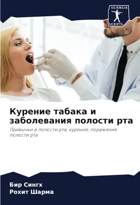 Заболевания зубов и полости рта - что это, симптомы, причины возникновения,  как проявляются, диагностика и способы лечения