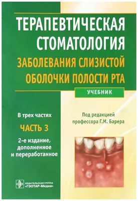 : Курение табака и заболевания полости рта: Привычки в полости рта,  курение, поражения полости рта (Russian Edition): 9786205968758: Сингх,  Бир, Шарма, Рохит