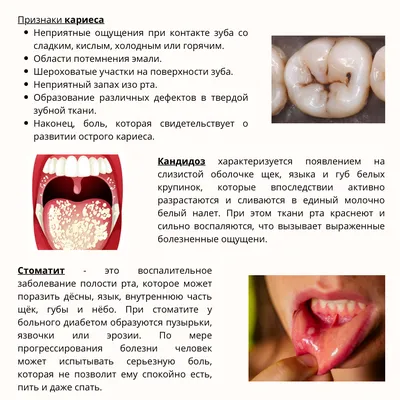 Изменения СОПР при болезнях крови и кроветворных органов