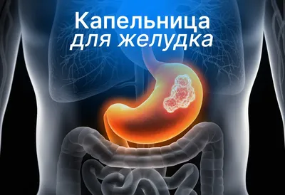 Капельница для желудка - Clean Clinic