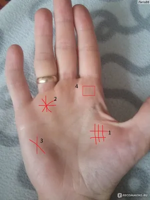 Видео: Как шрамы и царапины на руках могут изменить жизнь