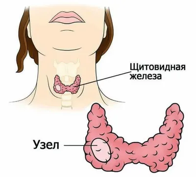 Рентгеновская диагностика заболеваний верхнего средостения | Второе мнение