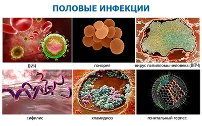 ЗППП, ИППП : анализы и лечение в клинике в Москве