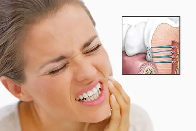 Острая зубная боль | Стоматология Бескудниково
