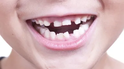 Зубы #23