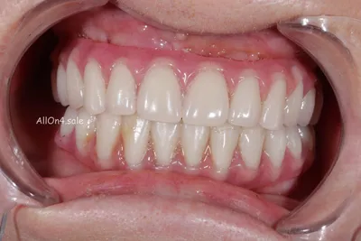 Лечат ли молочные зубы в стоматологических клиниках Минска